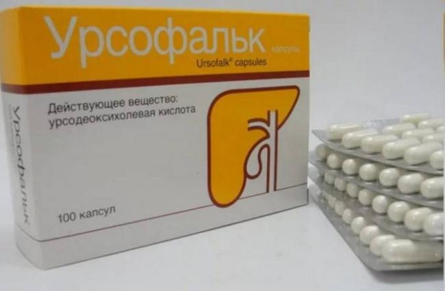 Что такое холелитиаз: симптомы и лечение