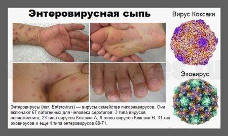 Аллергия на клюкву или реакция на северную ягоду