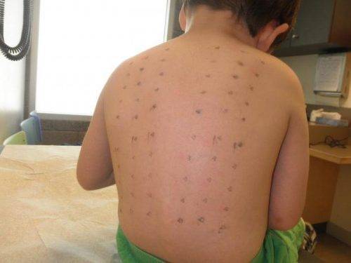 Педиатрическая панель (20 аллергенов)