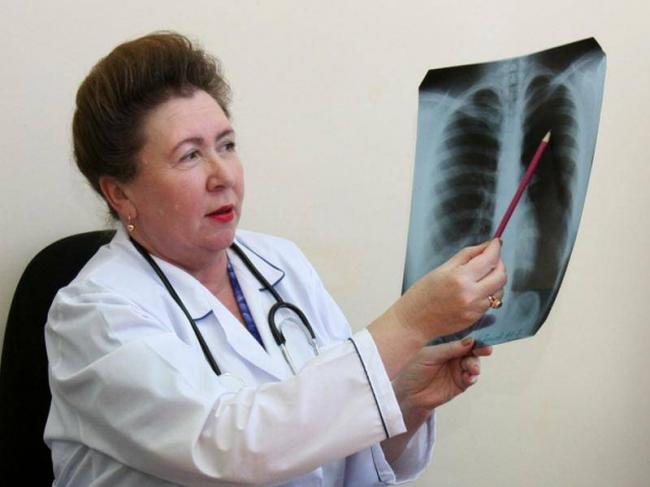 Открытая форма туберкулеза – особенности лечения и профилактики
