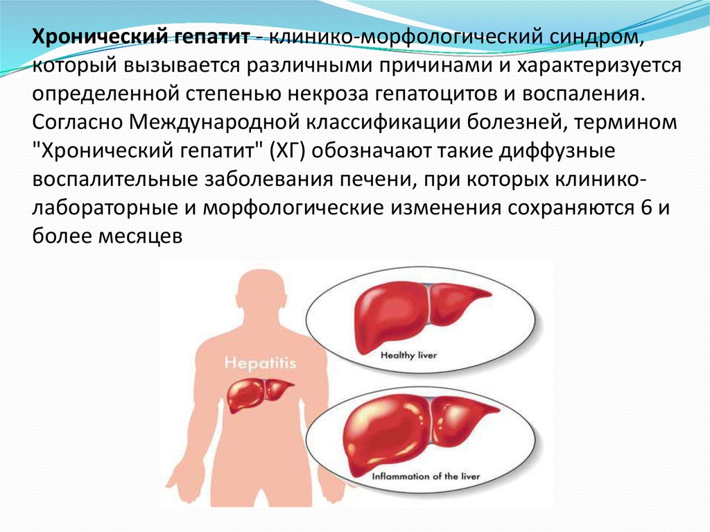 Дистрофические изменения печени: классификация, как лечить
