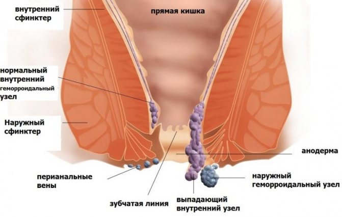 Как избавиться от жжения и зуда в заднем проходе при поносе