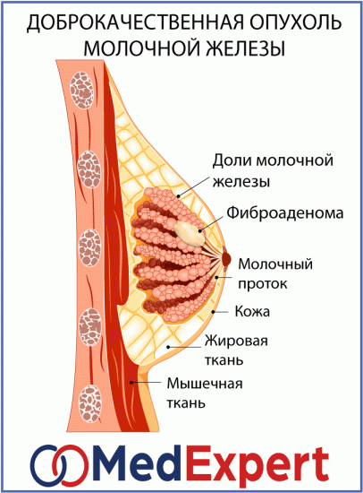 Что такое железистые ткани молочных желез?