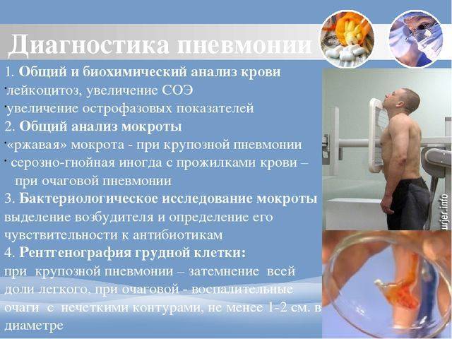 Показатели анализа крови при пневмонии
