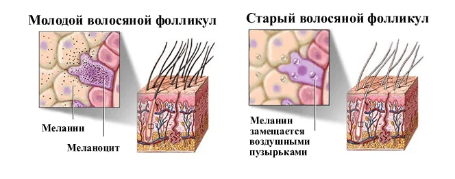 Ученые нашли способ борьбы с сединой