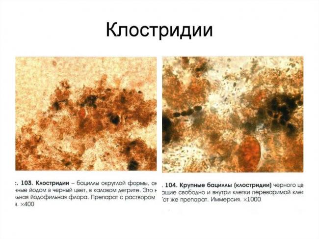 Понятие йодофильной флоры и причины его появления в кале