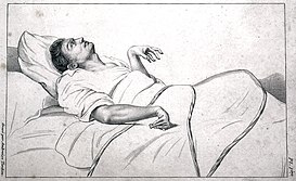 Абсанс — википедия. что такое абсанс