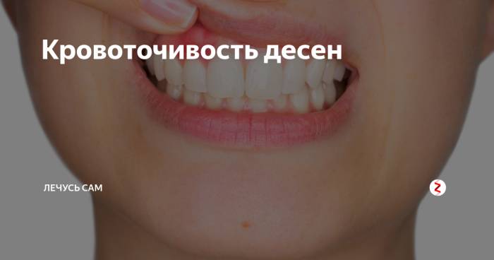 Кровоточивость дёсен и запах изо рта — могут быть причиной опасных болезней