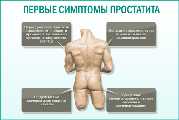 «афала» или «афалаза»: что лучше?