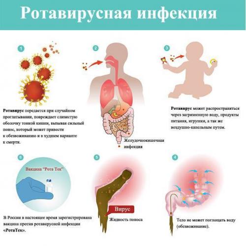 Как отличить вирусную инфекцию от бактериальной: симптомы, признаки, диагностика и лечение