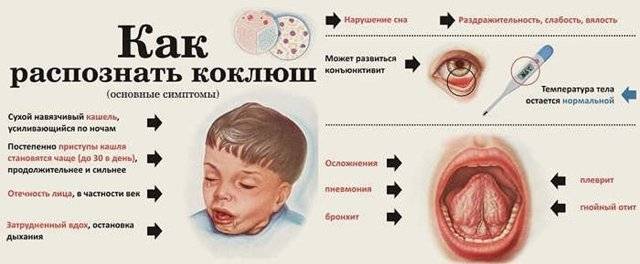 Как вылечить лающий кашель у детей
