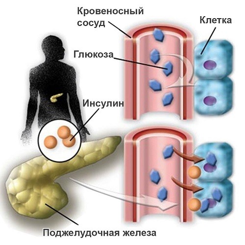 Сахарный диабет это эндокринное заболевание, характеризующееся хроническим повышением уровня сахара в крови вследствие абсолютного или относительного. - презентация