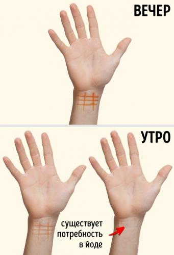 Зоб щитовидной железы. причины, симптомы, диагностика и лечение зоба