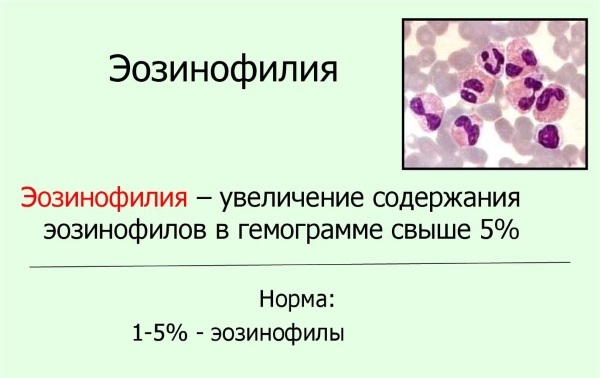 Эозинофилы понижены у взрослого и ребенка — о чем это говорит, как повысить