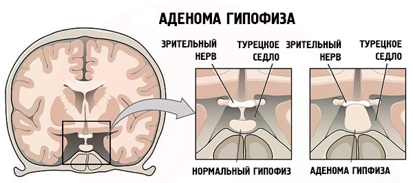 Гормон роста