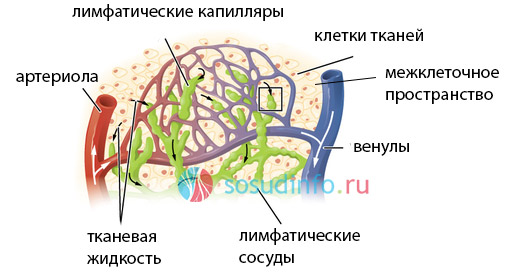 Лимфостаз нижних конечностей