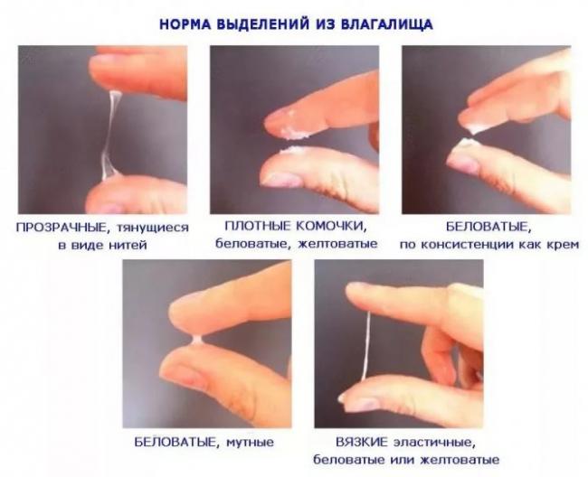 Желтые выделения без запаха у женщин — причины и методы лечения