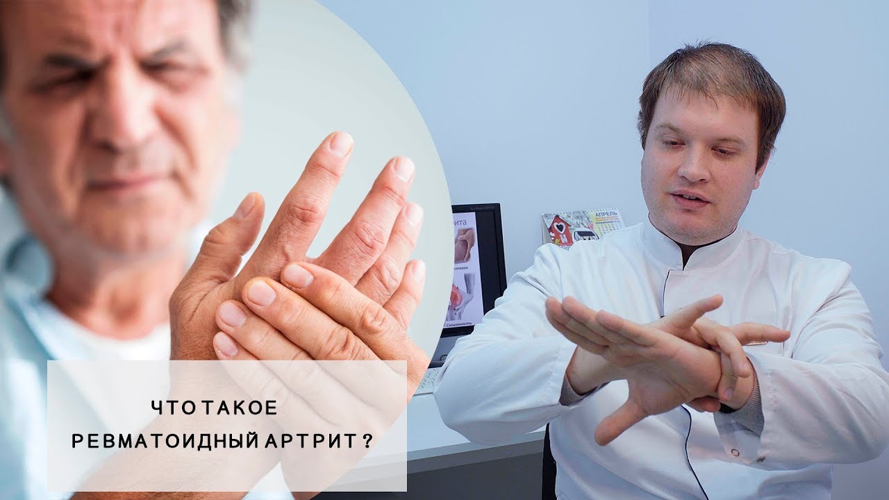 Что такое ревматоидный артрит, симптомы и лечение