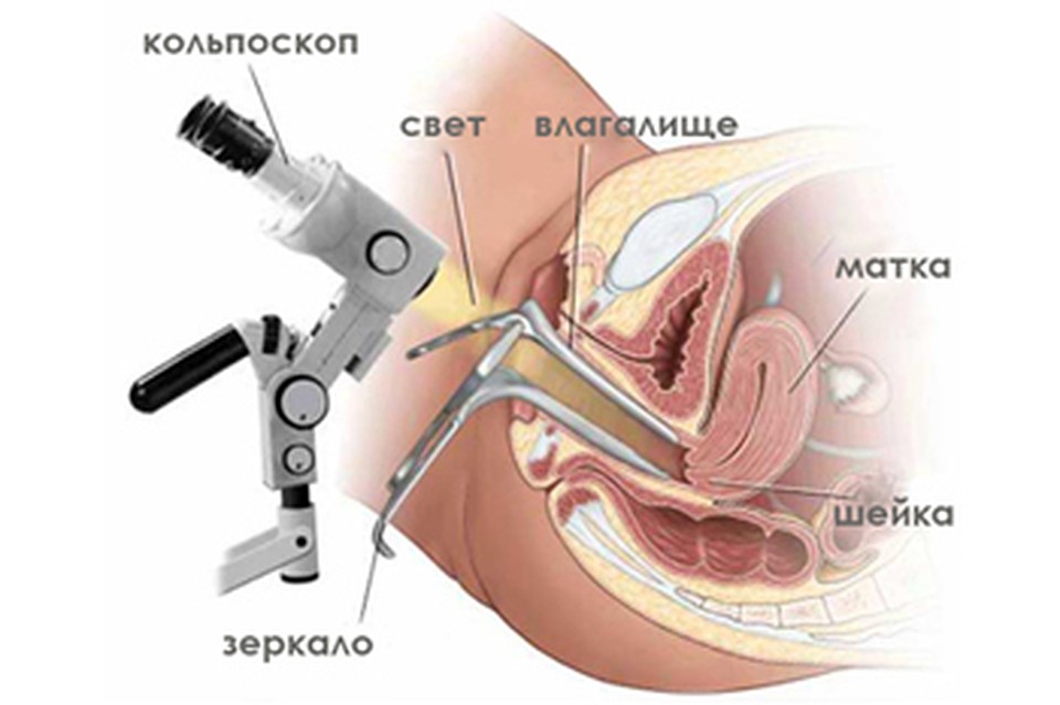 Отсутствие секса вызывает у мужчины импотенцию и смерть