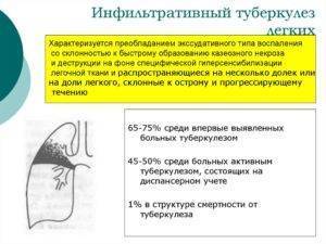 Инфильтративный туберкулез в фазе распада: что это такое, заразен он или нет