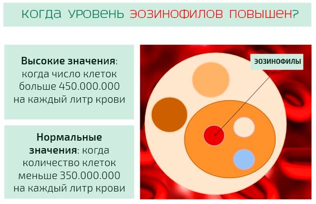 Эозинофилы повышены у ребенка в крови. причины, что значит абсолютное значение в анализе. лечение народными средствами