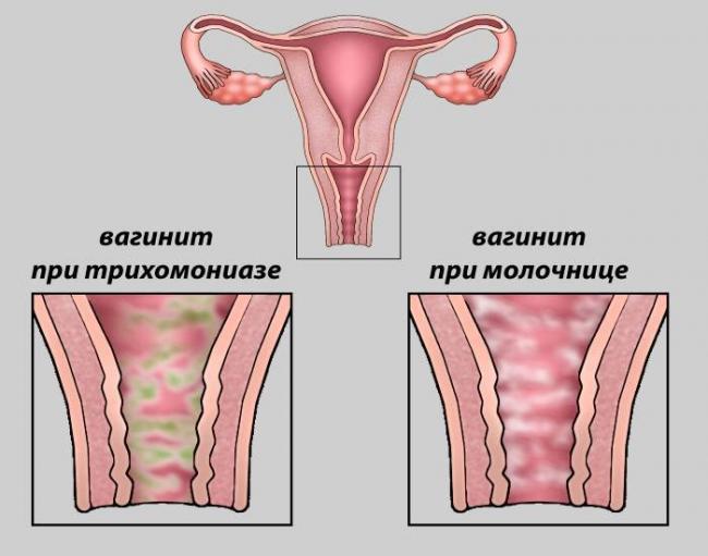 Бактериоскопическое исследование окрашенного мазка
