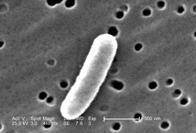 Escherichia coli в моче — диагностика, причины появления