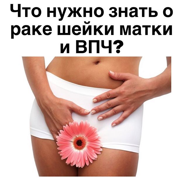 Рак шейки матки