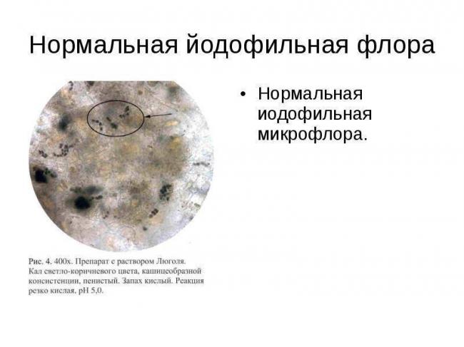 Причины появления йодофильной флоры в кале у ребенка