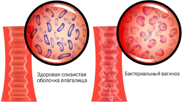 Эротекс отзывы