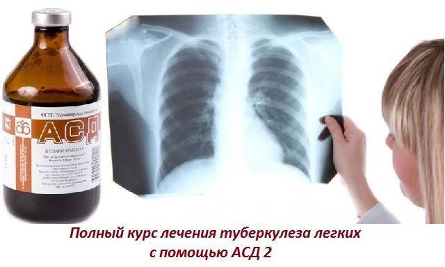 Как асд-2 помогает избавиться от туберкулеза