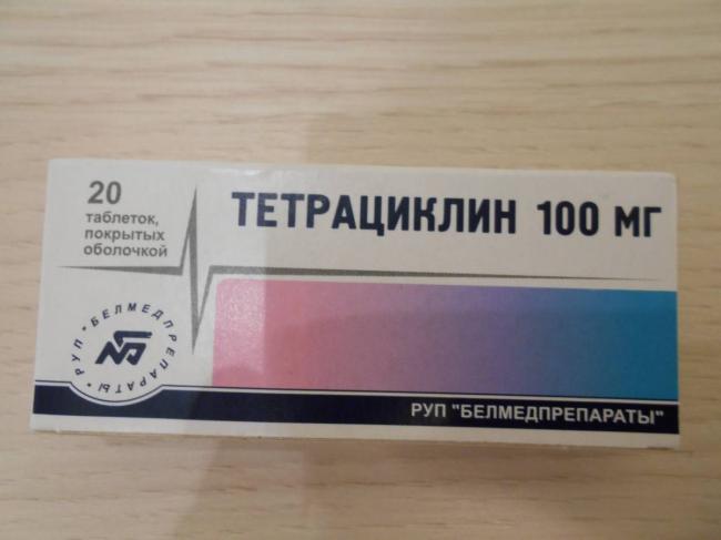 Хламидия пневмония: причины, диагностика и лечение