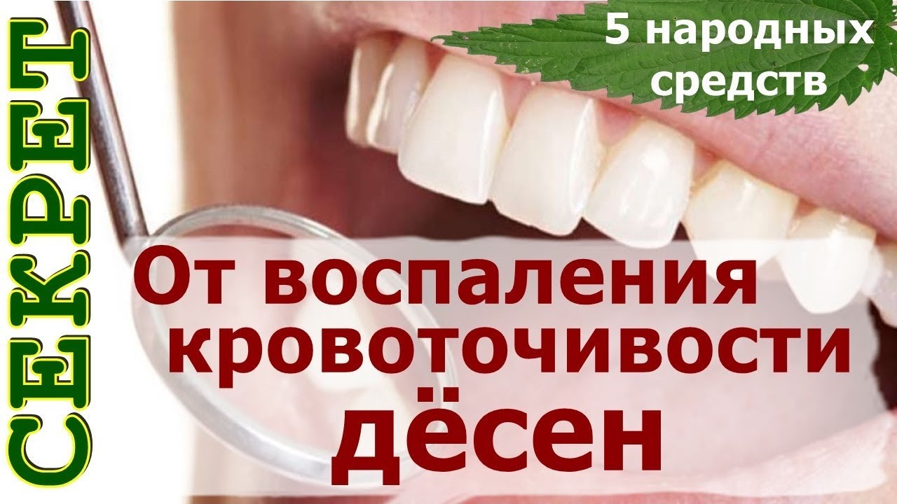 Кровоточат десна при чистке – причины, лечение, профилактика