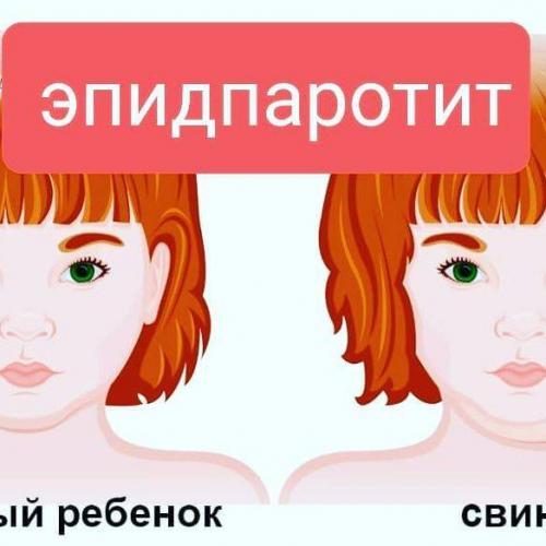 Ветрянка и краснуха у детей: переносятся легко. симптомы, лечение и уход за больным ребенком