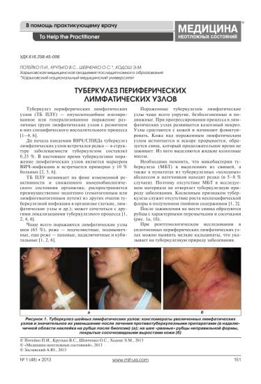 Какие лимфоузлы увеличиваются при туберкулезе