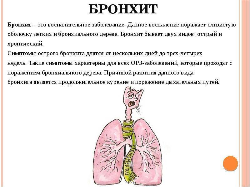 Подробно про лечение обострения хронического бронхита у взрослых — как распознать симптомы?