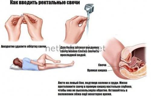 Лонгидаза лиофилизат - официальная инструкция по применению