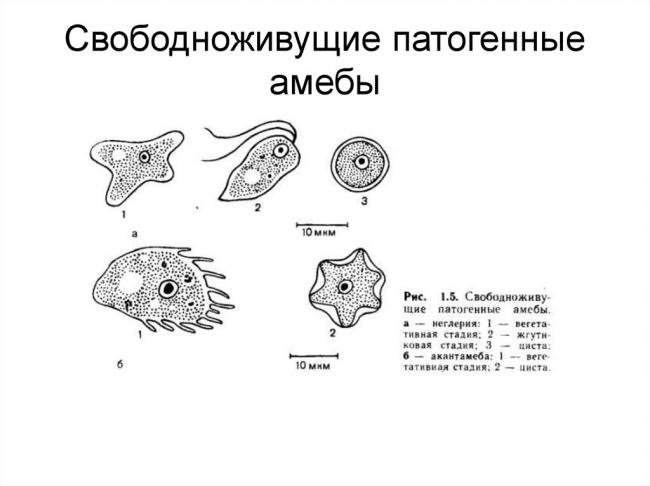 Акантамёбный кератит :: симптомы и лечение