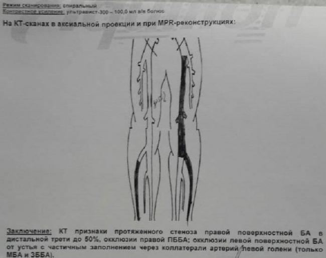 Отсутствие секса вызывает у мужчины импотенцию и смерть