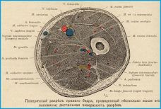 Невропатия