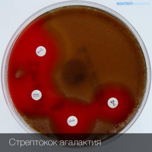 Ольга бутакова: важно! бактерии, с которыми мы встречаемся каждый день