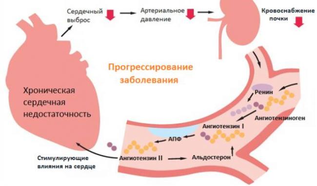 Пневмония на фоне сердечной недостаточности