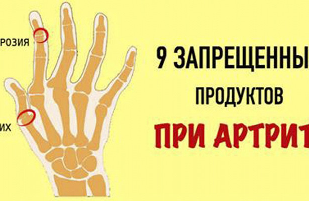 Как правильно питаться, если у вас полиартрит суставов?