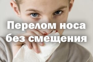 Перелом костей носа: причины, симптомы, лечение