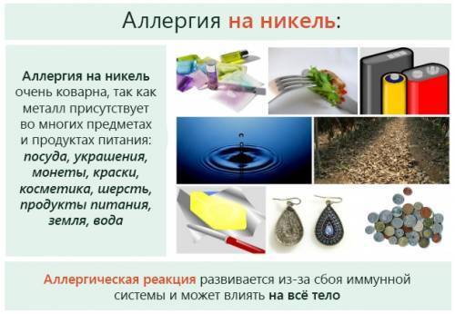 Аллергия на металл