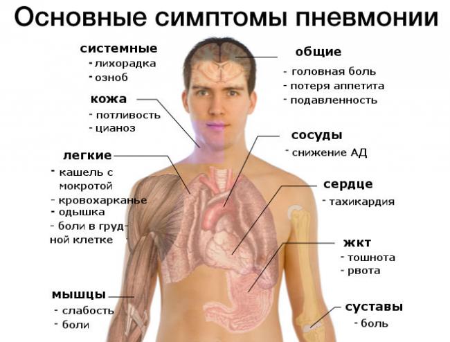 Пневмония. причины, симптомы, современная диагностика и эффективное лечение болезни.