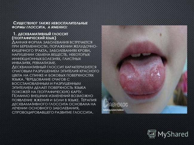 Народные средства от гайморита у детей