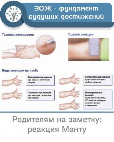 Положительная реакция манту у ребенка: что это значит, что делать, причины, как выглядит проба при туберкулезе у детей, фото