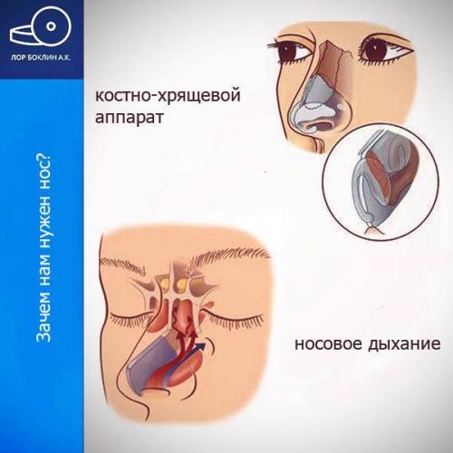 Ринит атрофический