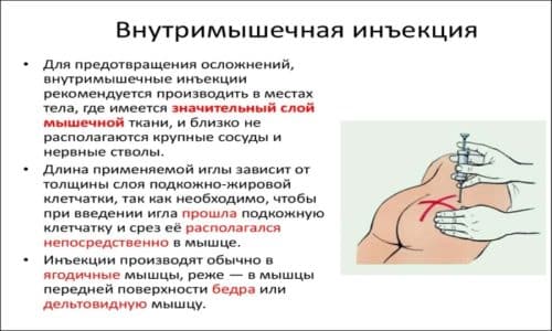 Дипроспан